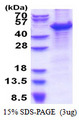 MCM7 Protein