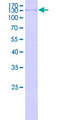 MCM8 Protein - 12.5% SDS-PAGE of human MCM8 stained with Coomassie Blue