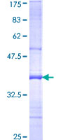 MCM9 Protein - 12.5% SDS-PAGE Stained with Coomassie Blue.