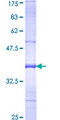 MCM9 Protein - 12.5% SDS-PAGE Stained with Coomassie Blue.