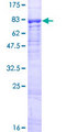 MCMDC2 / C8orf45 Protein - 12.5% SDS-PAGE of human C8orf45 stained with Coomassie Blue