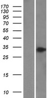 MCNAA / BPHL Protein - Western validation with an anti-DDK antibody * L: Control HEK293 lysate R: Over-expression lysate