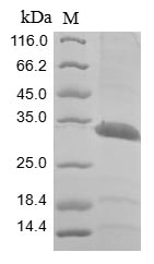 MCNAA / BPHL Protein - (Tris-Glycine gel) Discontinuous SDS-PAGE (reduced) with 5% enrichment gel and 15% separation gel.