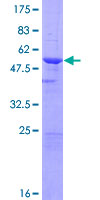 MCNAA / BPHL Protein - 12.5% SDS-PAGE of human BPHL stained with Coomassie Blue