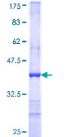 MCNAA / BPHL Protein - 12.5% SDS-PAGE Stained with Coomassie Blue.
