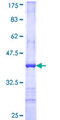 MCNAA / BPHL Protein - 12.5% SDS-PAGE Stained with Coomassie Blue.