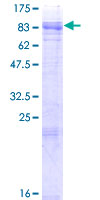 MCOLN1 / Mucolipin 1 Protein - 12.5% SDS-PAGE of human MCOLN1 stained with Coomassie Blue