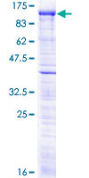 MCPH1 Protein - 12.5% SDS-PAGE of human MCPH1 stained with Coomassie Blue