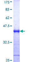 MCPH1 Protein - 12.5% SDS-PAGE Stained with Coomassie Blue.