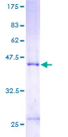 MCTS1 Protein - 12.5% SDS-PAGE of human MCTS1 stained with Coomassie Blue