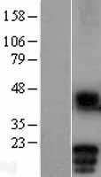 MD-1 / LY86 Protein - Western validation with an anti-DDK antibody * L: Control HEK293 lysate R: Over-expression lysate