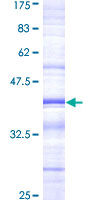 MD-1 / LY86 Protein - 12.5% SDS-PAGE Stained with Coomassie Blue.