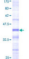 MD-1 / LY86 Protein - 12.5% SDS-PAGE Stained with Coomassie Blue.