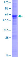 MDFI / I-MF Protein - 12.5% SDS-PAGE of human MDFI stained with Coomassie Blue