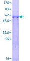 MDH / MDH2 Protein - 12.5% SDS-PAGE of human MDH2 stained with Coomassie Blue