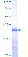 MDH / MDH2 Protein - 12.5% SDS-PAGE Stained with Coomassie Blue.