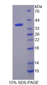 MDH / MDH2 Protein - Recombinant Malate Dehydrogenase 2 By SDS-PAGE