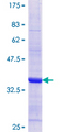 MDH1 Protein - 12.5% SDS-PAGE Stained with Coomassie Blue.
