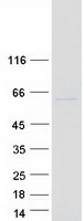 MDH1B Protein - Purified recombinant protein MDH1B was analyzed by SDS-PAGE gel and Coomassie Blue Staining