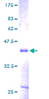 MDK / Midkine Protein - 12.5% SDS-PAGE of human MDK stained with Coomassie Blue