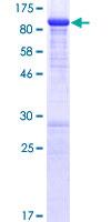 MDM4 / MDMX Protein - 12.5% SDS-PAGE of human MDM4 stained with Coomassie Blue