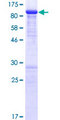 MDM4 / MDMX Protein - 12.5% SDS-PAGE of human MDM4 stained with Coomassie Blue