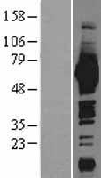 ME1 / Malate Dehydrogenase Protein - Western validation with an anti-DDK antibody * L: Control HEK293 lysate R: Over-expression lysate