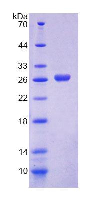 ME2 / Malate Dehydrogenase 2 Protein - Recombinant  Malic Enzyme 2, NADP+ Dependent, Mitochondrial By SDS-PAGE