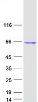 ME2 / Malate Dehydrogenase 2 Protein - Purified recombinant protein ME2 was analyzed by SDS-PAGE gel and Coomassie Blue Staining