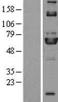 ME3 Protein - Western validation with an anti-DDK antibody * L: Control HEK293 lysate R: Over-expression lysate