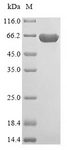 ME3 Protein - (Tris-Glycine gel) Discontinuous SDS-PAGE (reduced) with 5% enrichment gel and 15% separation gel.