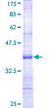 MECOM / EVI1 Protein - 12.5% SDS-PAGE Stained with Coomassie Blue.