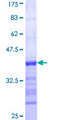 MECOM / EVI1 Protein - 12.5% SDS-PAGE Stained with Coomassie Blue.