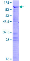 MECP2 Protein - 12.5% SDS-PAGE of human MECP2 stained with Coomassie Blue