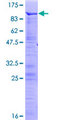 MECP2 Protein - 12.5% SDS-PAGE of human MECP2 stained with Coomassie Blue