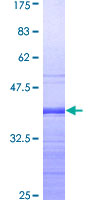 MECP2 Protein - 12.5% SDS-PAGE Stained with Coomassie Blue.
