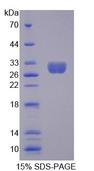 MECP2 Protein - Recombinant Methyl CpG Binding Protein 2 (MECP2) by SDS-PAGE