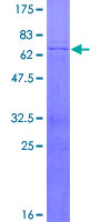 MECR Protein - 12.5% SDS-PAGE of human MECR stained with Coomassie Blue