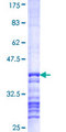 MECR Protein - 12.5% SDS-PAGE Stained with Coomassie Blue.