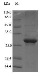 MED1 / TRAP220 Protein - (Tris-Glycine gel) Discontinuous SDS-PAGE (reduced) with 5% enrichment gel and 15% separation gel.