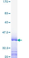 MED1 / TRAP220 Protein - 12.5% SDS-PAGE Stained with Coomassie Blue.