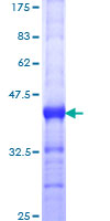 MED12 Protein - 12.5% SDS-PAGE Stained with Coomassie Blue.