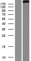 MED13L Protein - Western validation with an anti-DDK antibody * L: Control HEK293 lysate R: Over-expression lysate