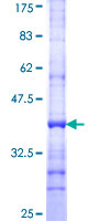 MED13L Protein - 12.5% SDS-PAGE Stained with Coomassie Blue.