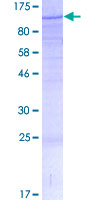 MED15 / ARC105 Protein - 12.5% SDS-PAGE of human MED15 stained with Coomassie Blue
