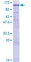 MED16 / THRAP5 Protein - 12.5% SDS-PAGE of human MED16 stained with Coomassie Blue