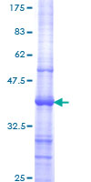 MED16 / THRAP5 Protein - 12.5% SDS-PAGE Stained with Coomassie Blue.