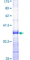 MED17 / TRAP80 Protein - 12.5% SDS-PAGE Stained with Coomassie Blue.