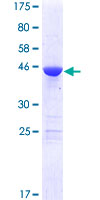 MED18 Protein - 12.5% SDS-PAGE of human MED18 stained with Coomassie Blue