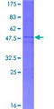 MED19 Protein - 12.5% SDS-PAGE of human MED19 stained with Coomassie Blue